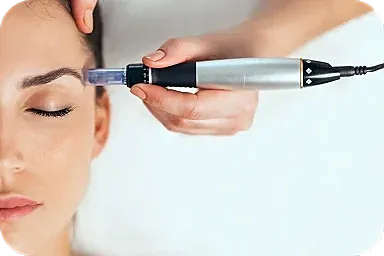 Microneedling procedure on woman's eyebrow area