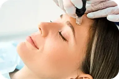 Woman receiving a skincare treatment with microneedling.