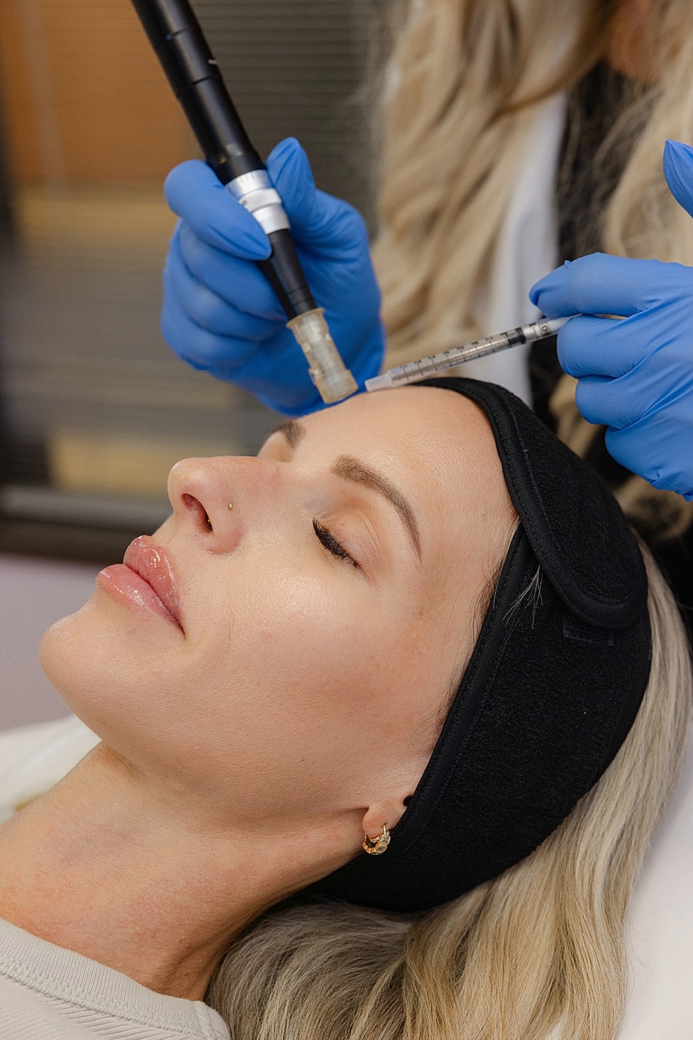 Microneedling treatment in a beauty clinic setting.