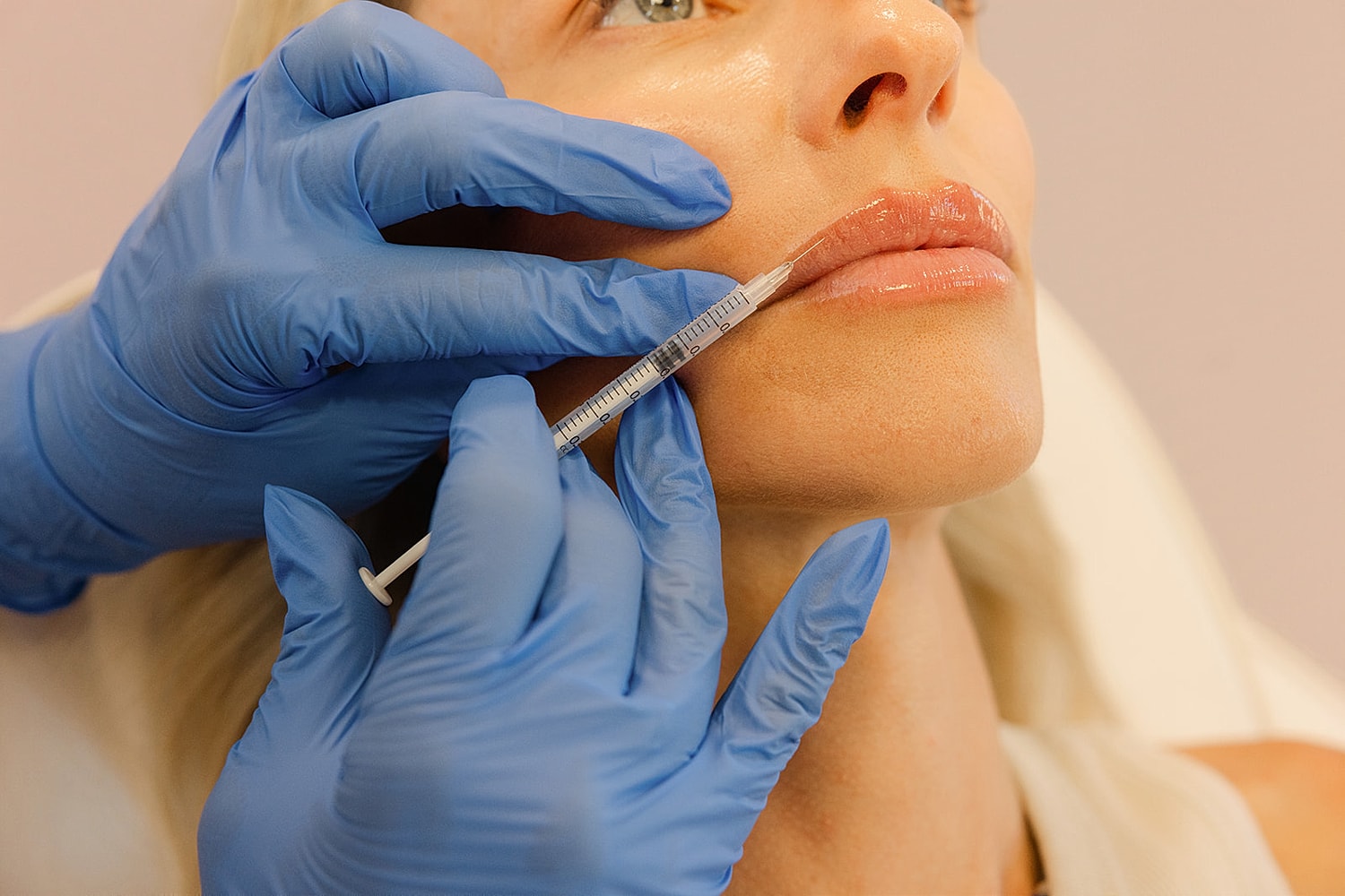 Administering lip filler treatment to woman.